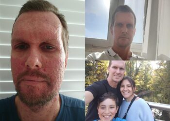 Bowel cancer symptoms: Fit and healthy father diagnosed with stage 4 colorectal cancer reveals first warning sign