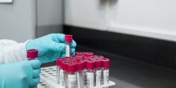 Detecting Alzheimer’s Disease in the Blood
