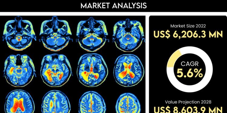Global Alzheimer’s Disease Diagnostics and Therapeutics Market 2022: Covering Prime Factors and Competitive Outlook of Top Industry Players Till 2028 | Luye Pharma Group, Vigil Neuroscience, Grifols SA, Corium International