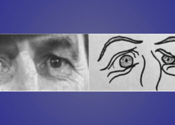 Autistic people outperform neurotypicals in a cartoon version of an emotion recognition task