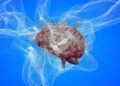 Educational Background and Previous Brain Injury May Be Associated With Higher Risk of Frontotemporal Dementia