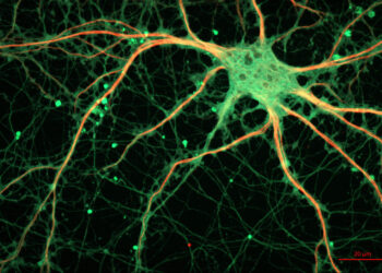 Neuroscience research suggests LSD might enhance learning and memory by promoting brain plasticity