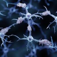 Alzheimer’s Treatments on Near Horizon for Iowans | News