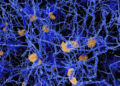 Blood test in study detects toxic proteins fundamental to dementia before symptoms develop
