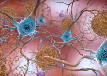 Alzheimer’s drug lecanemab may slow losses in memory and thinking, study says : Shots