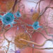 Alzheimer’s drug lecanemab may slow losses in memory and thinking, study says : Shots