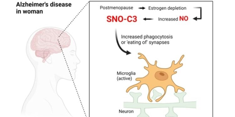 Discovery Could Explain Why Women Are More Likely to Get Alzheimer’s