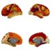 Obesity-Related Neurodegeneration Mimics Alzheimer’s Disease