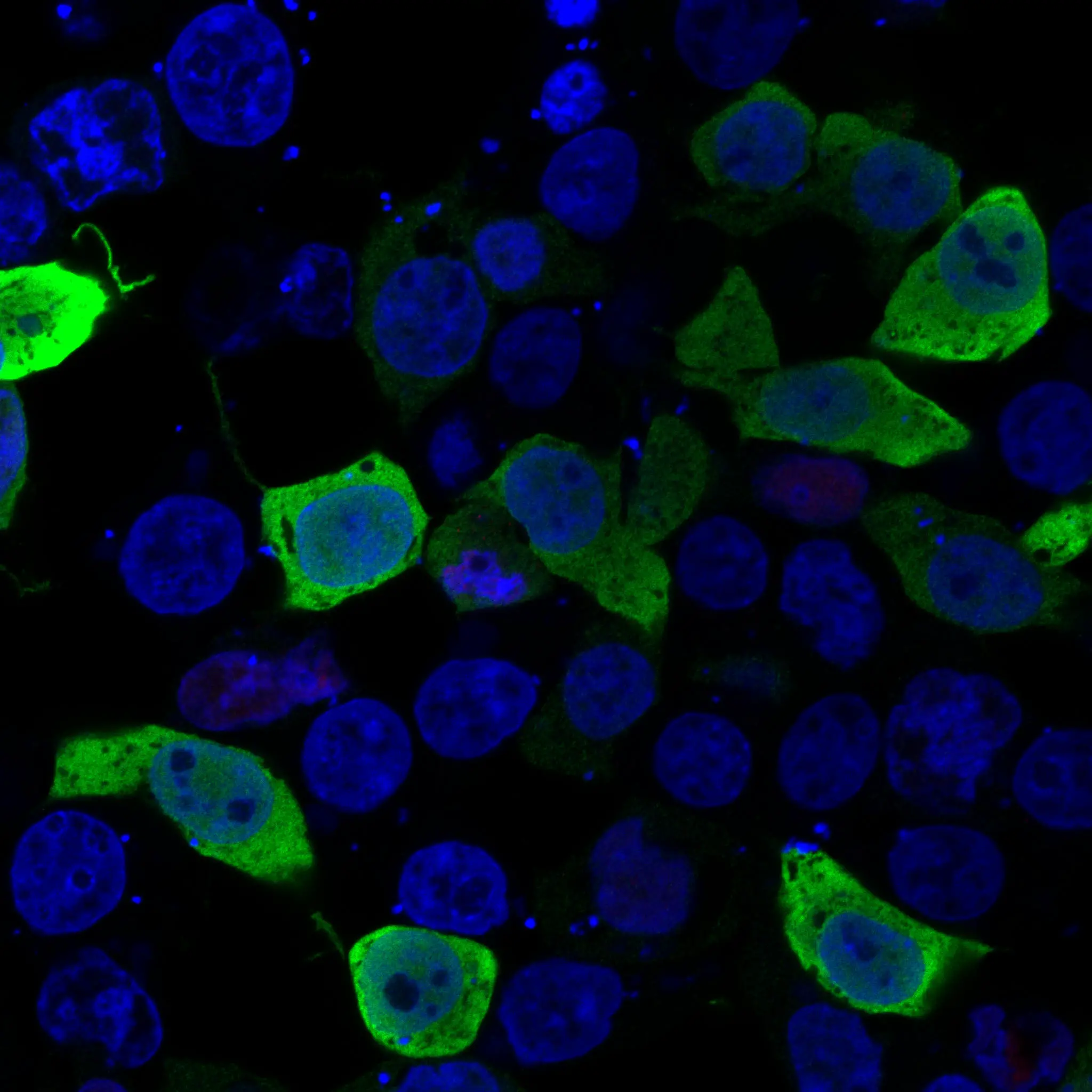 Scientists Have Identified the Genetic Causes of Three Previously Unexplained Rare Diseases