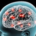 Brain implant can objectively measure chronic pain severity