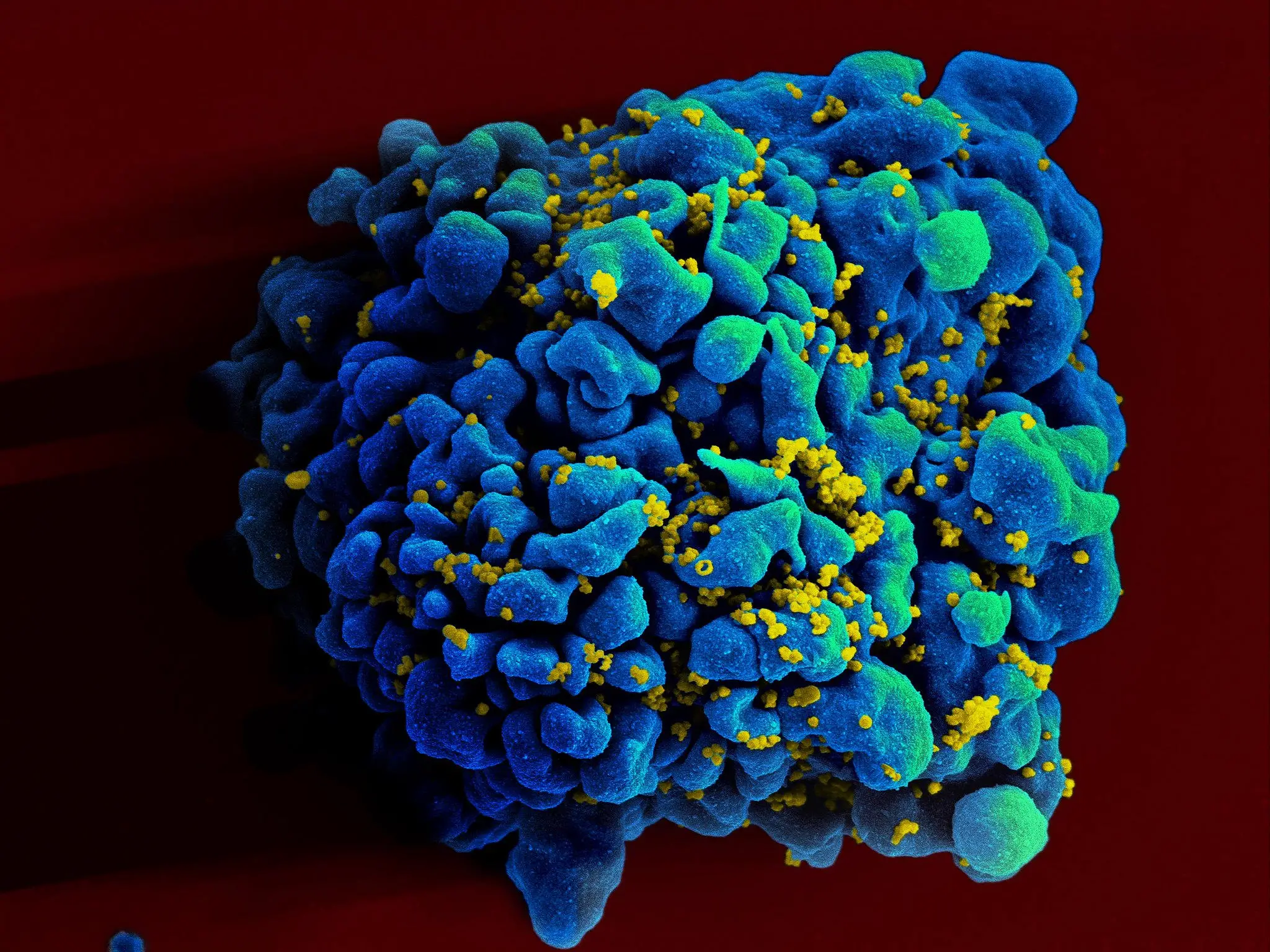 Readily Available Dietary Supplement Reverses HIV-Related Organ Damage in Preclinical Trials