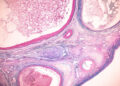 What Do Ovarian Reserve Test Results Mean? (And Can I Improve Them?)