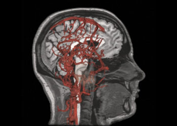 High blood pressure and stiff arteries linked to cognitive issues in adolescents, study finds