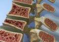 Scientists Discover a New Hormone That Can Double Bone Mass