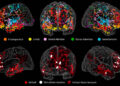 Neuroscientists identify brain network critical for creative idea generation
