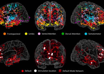 Neuroscientists identify brain network critical for creative idea generation