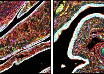 Scientists Uncover Hidden Cells That Spark Ovarian Cancer’s Deadly Growth