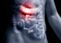 This Common Gut-Bacteria Compound May Be Linked to Alzheimer’s Disease