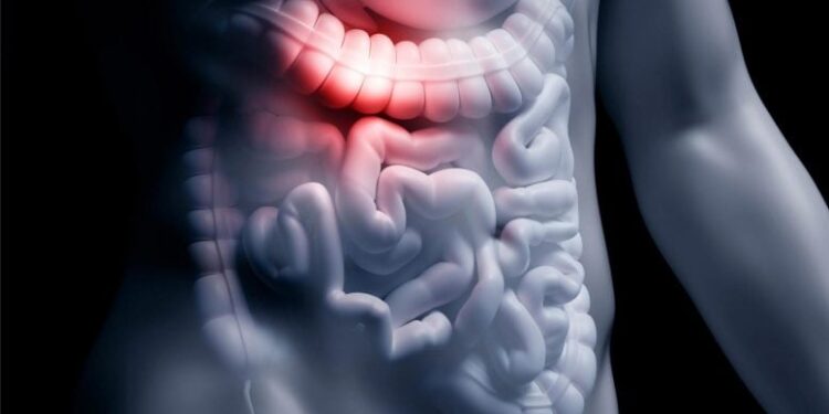 This Common Gut-Bacteria Compound May Be Linked to Alzheimer’s Disease